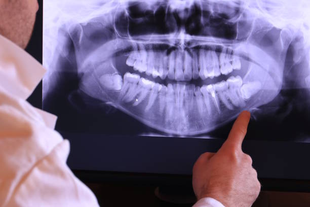 Best Emergency Root Canal Treatment in Bourbon, MO